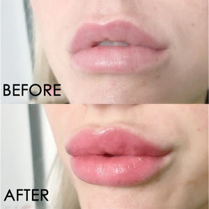 Natural Instant Volumizing Lip Plumper Enhancement