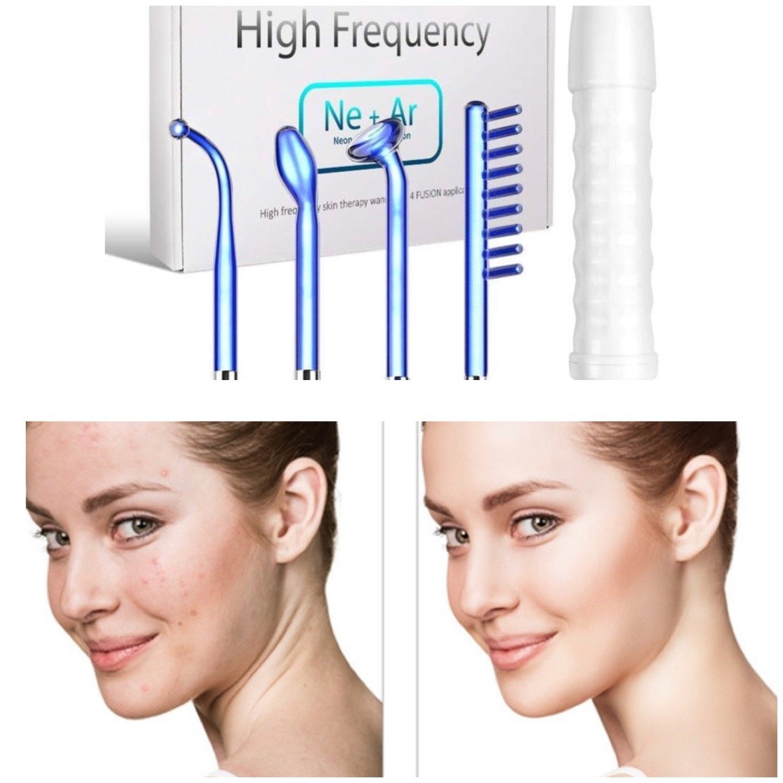 You Love We Ship Health & Beauty Fusion Therapy Kit Fusion High Frequency Facial Therapy Goodbye Acne, Wrinkles, Hair Loss & Cellulite.
